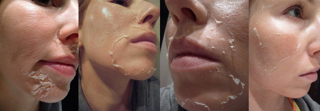 PerfectPeel.pl - najlepszy peeling już w Polsce